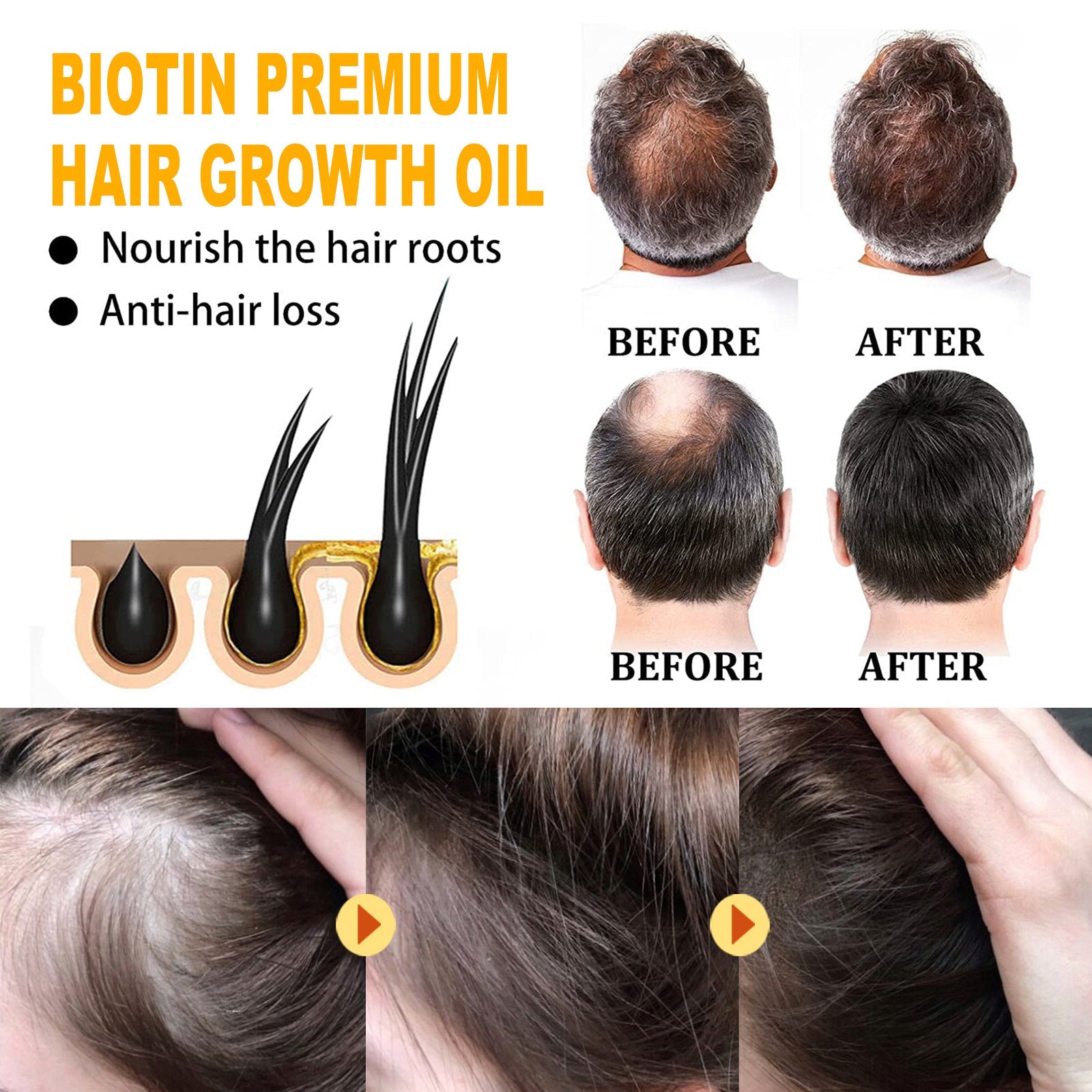 EELHOE Biotin Hair Treatment Oil Deeply Moisturizing Scalp Massage Treatment Thick And Smooth Hair Care Oil - Shiluxebeautyandhealth.com