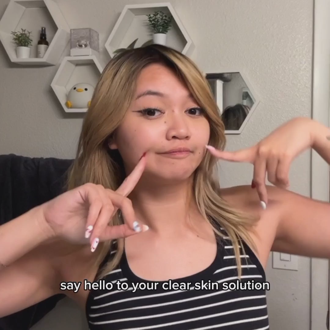 Charcoal Soap & Facial Cleanser For Acne, Oily Skin, Dark Spots, & Blemishes, For Both Men & Women, Made With Aloe Vera, Activated Charcoal, Vitamin E, & Tea Tree Blend- Paraben-Free (Pack Of 2 Units Of Each)